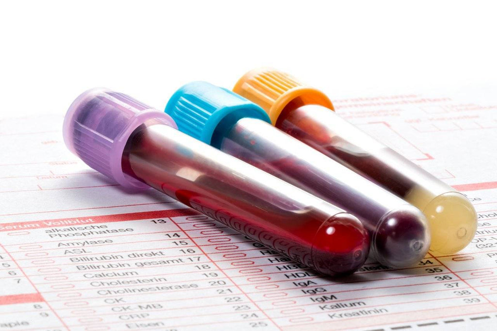 Blutwerte - Die wichtigsten Blutwerte verstehen und auswerten