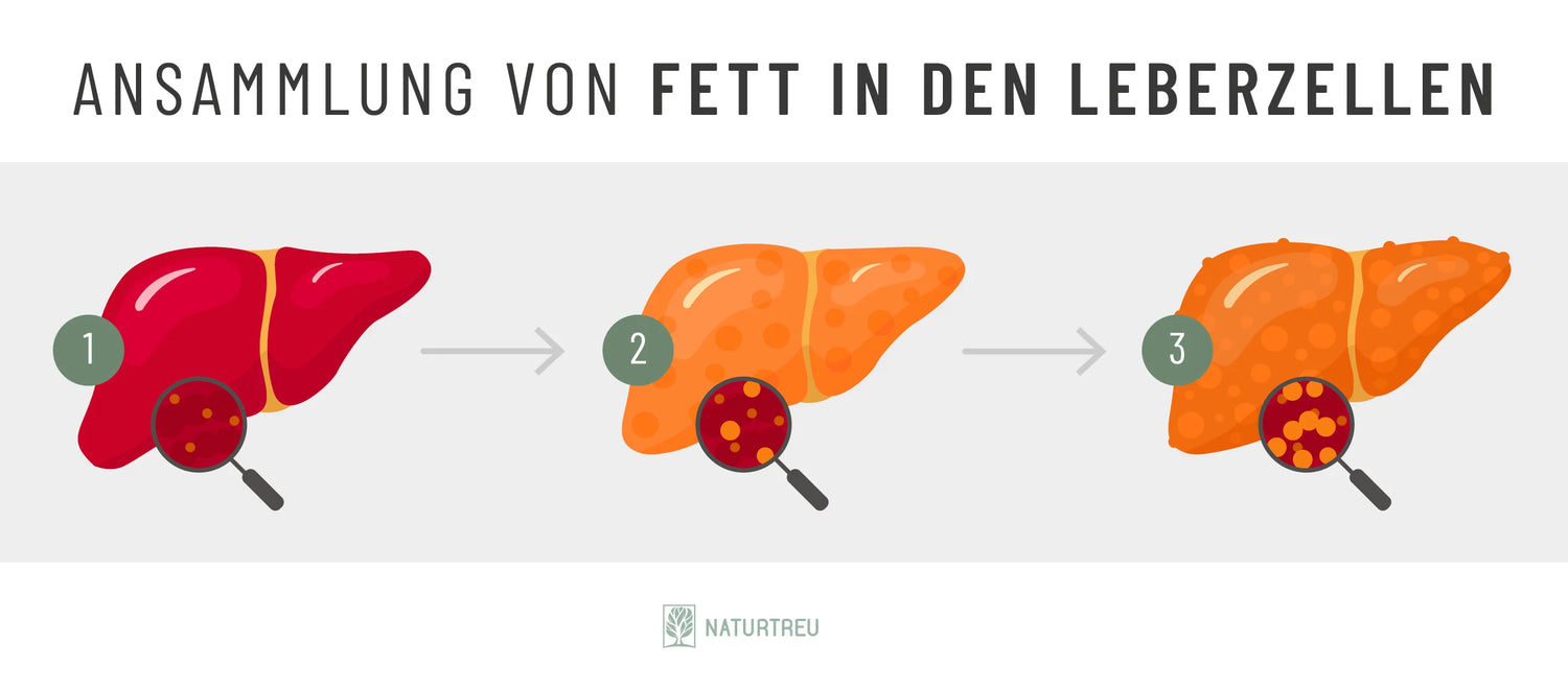 Darstellung einer von zu viel Fett belasteten Leber 